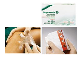 MEDICAZIONE STERILE IN FILM IN POLIURETANO TRASP. SUPRASORB F 10X12CM 10 PEZZI - Farmadillo